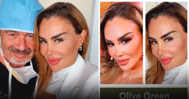 Ninel Conde se cambia el color de ojos en una costosa cirugía de más de 200 mil pesos