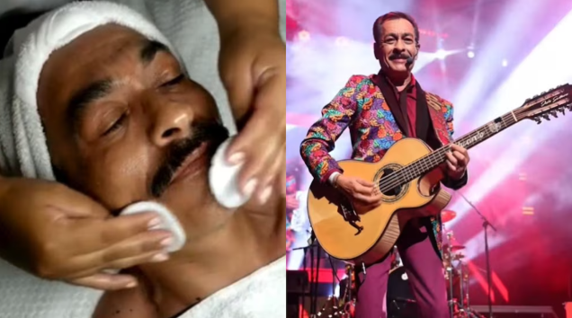 Eduardo Hernández de Los Tigres del Norte presume tratamiento de belleza