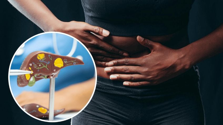 Estos son los alimentos que podrían estar dañando tu hígado sin que te des cuenta ¡Evítalos!